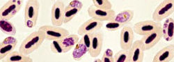 Malarial parasites in red blood cells
